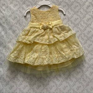 Baby Yellow Dress